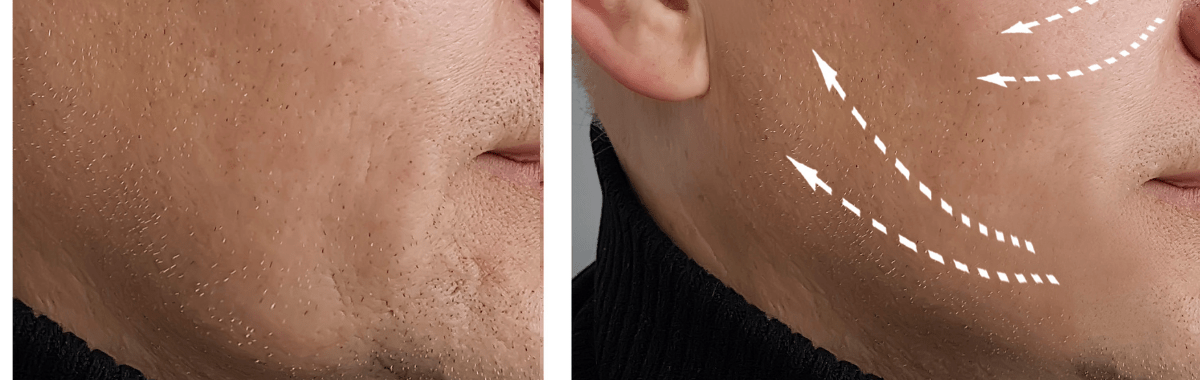 Men’s Anti-Aging Sets & Combos