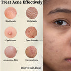 Clears spots. Calms redness. Smooths texture. The ultimate teen skin reset