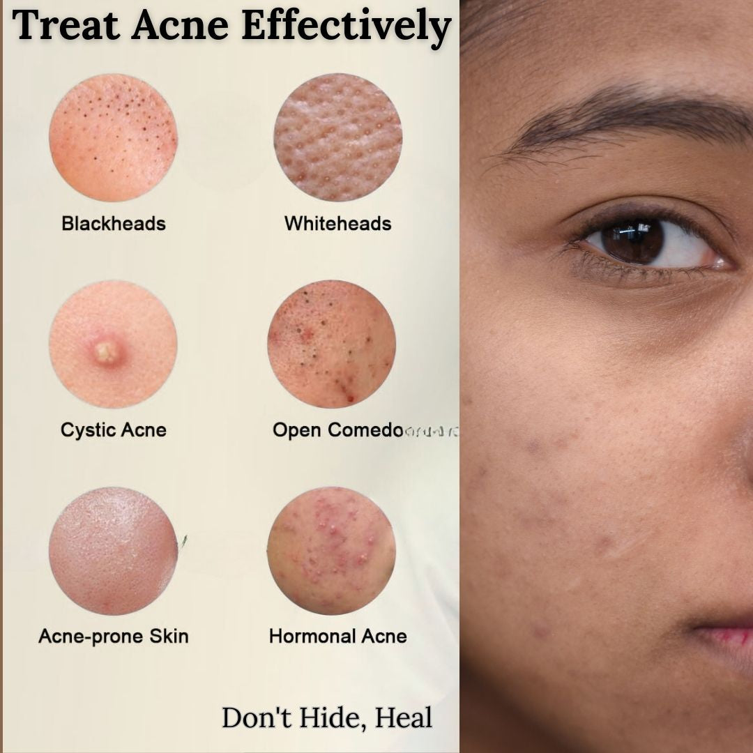Clears spots. Calms redness. Smooths texture. The ultimate teen skin reset
