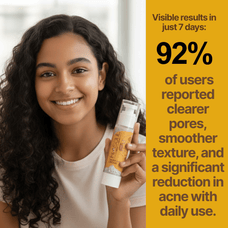 Himsoul Teen Anti-Acne Cream