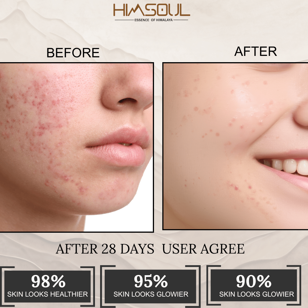 Before and after 28-day comparison showing significant skin healing with 98% agreeing skin looks healthier.